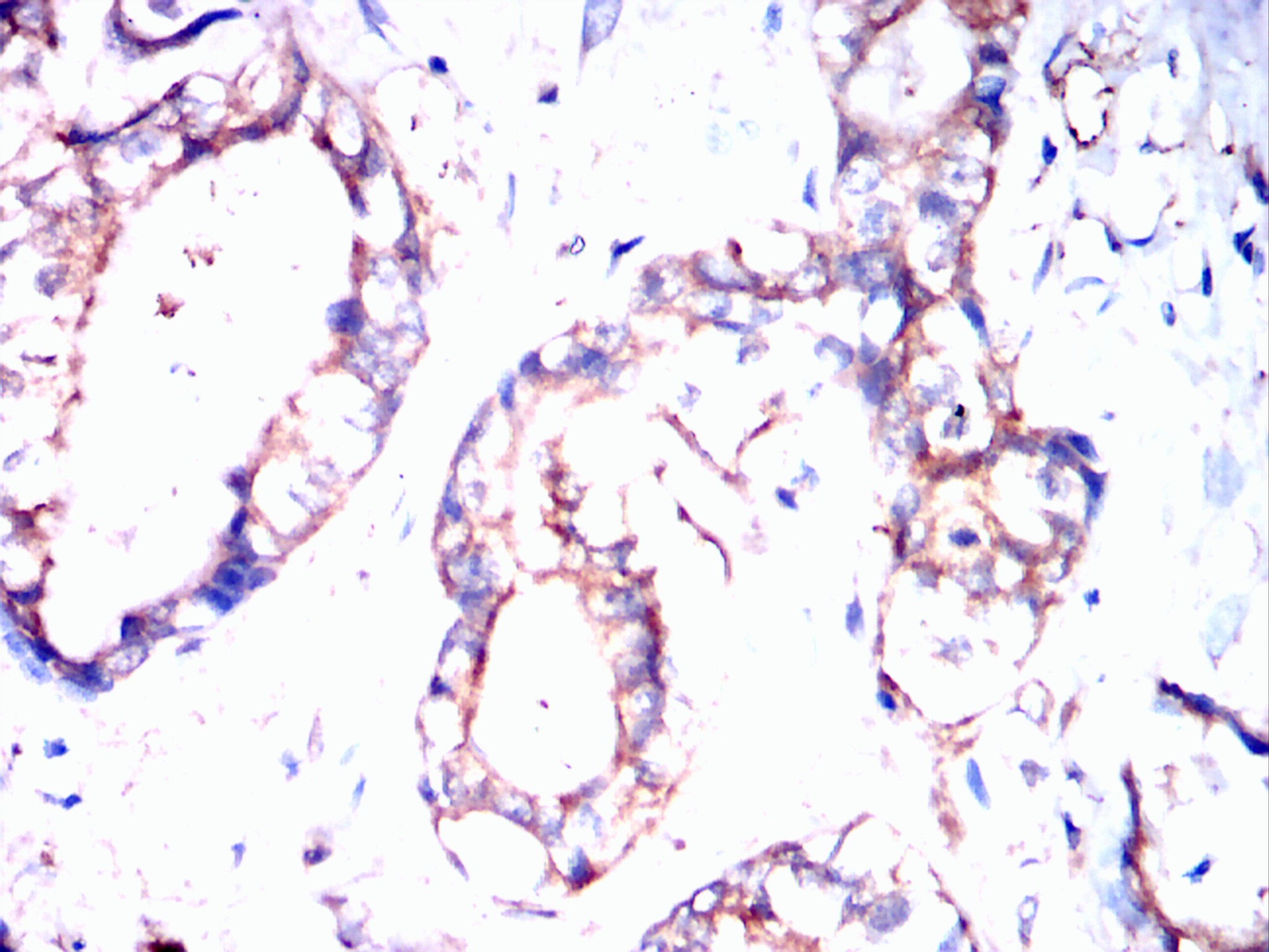                  IHC